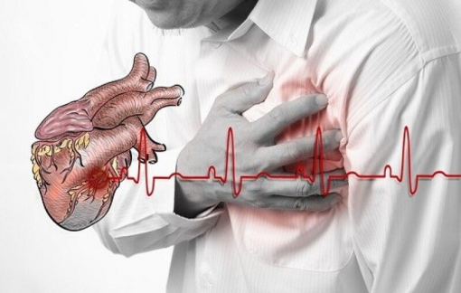 Đau thắt ngực là dấu hiệu của nhồi máu cơ tim?