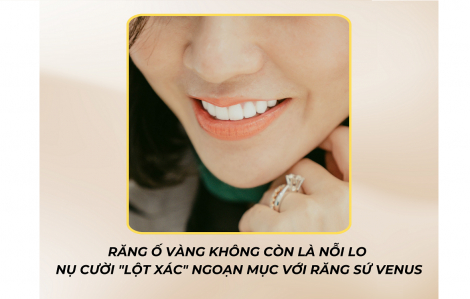 Răng ố vàng không còn là nỗi lo với thẩm mỹ răng sứ Venus