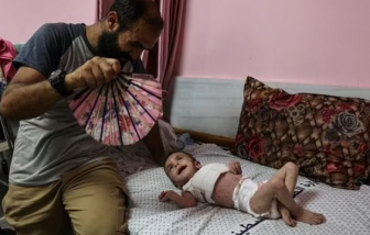Các bệnh ngoài da nguy hiểm đang lây lan ở trẻ em tại Dải Gaza