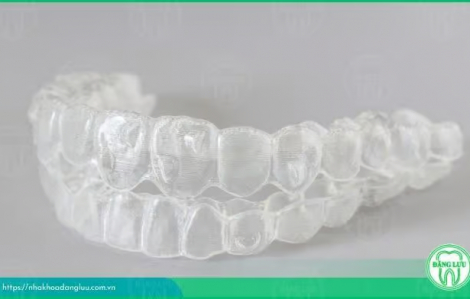 Niềng răng invisalign tại Nha khoa Đăng Lưu