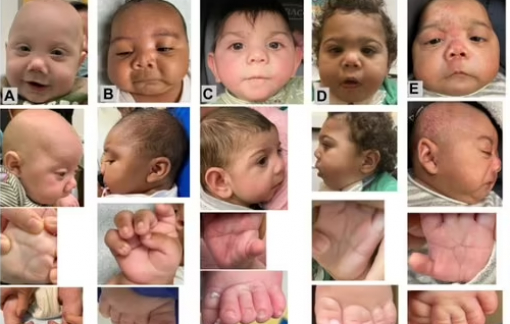 Hàng chục trẻ sơ sinh ở Mỹ bị dị tật vì mẹ dùng "thuốc xác sống"