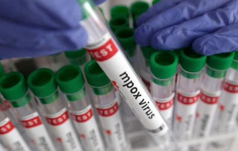 Jordan ghi nhận ca đậu mùa khỉ đầu tiên trong năm 2024