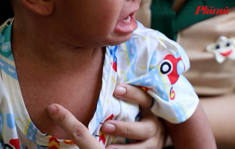 Số ca sốt phát ban nghi sởi tại TPHCM tăng hơn gấp đôi trong tuần qua