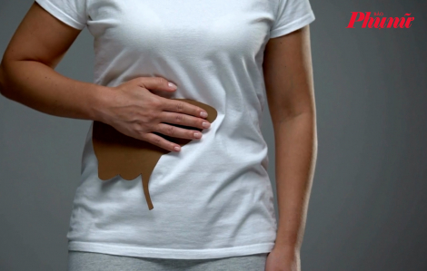 Uống 2.000 viên thuốc trong 20 ngày, người phụ nữ nhập viện với men gan cao gấp 20 lần