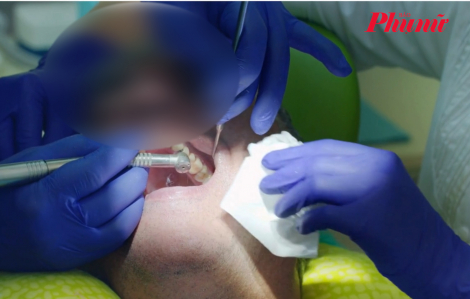 Tử vong sau khi nhổ 23 chiếc răng trong một ngày