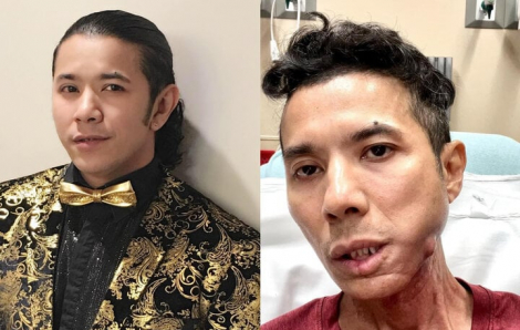 Ca sĩ Kasim Hoàng Vũ mắc bệnh nặng, không thể tiếp tục ca hát