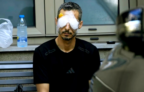 Bác sĩ chạy đua cứu từng đôi mắt của bệnh nhân ở Lebanon