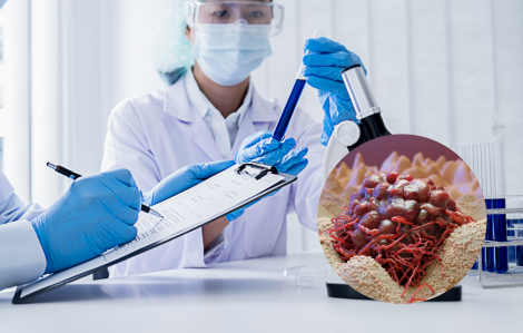 Phát triển kháng thể mới có khả năng điều trị nhiều loại ung thư