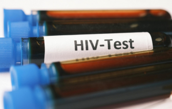 Số ca nhiễm và tử vong do HIV trên toàn cầu giảm mạnh