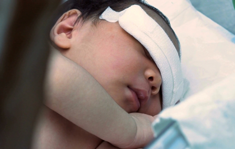 Bé 13 tháng tuổi mắc bệnh sởi tử vong