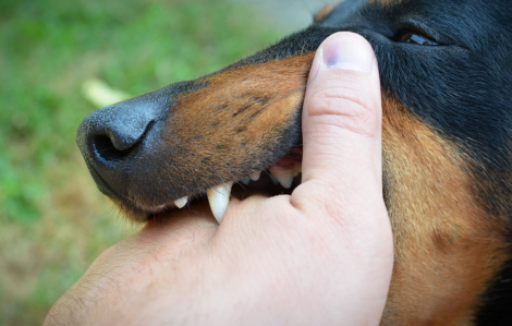 Bé gái 4 tuổi qua đời sau 24 ngày bị chó cắn, cả gia đình bị phơi nhiễm dại