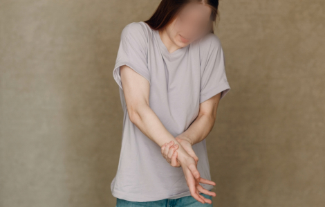 Cô gái trẻ đang khỏe mạnh bỗng dưng bị tâm thần vì lý do hiếm gặp