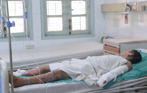 Liên tiếp các trường hợp bệnh nhi nhập viện do chế pháo