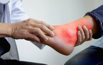 Suy đa tạng vì tự ý chữa gout