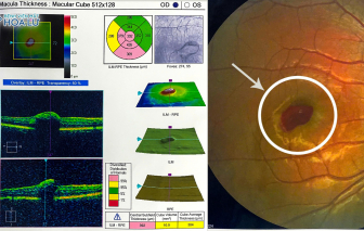 Chàng trai bị ‘mù tạm thời’ vì đèn laser sân khấu