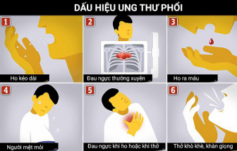 Số ca ung thư phổi gia tăng ở những người phụ nữ chưa bao giờ hút thuốc lá