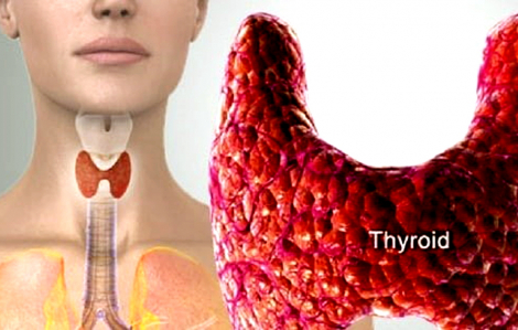 Nỗi lo về tình trạng thiếu i ốt đang trở lại