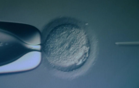 Thụ tinh ống nghiệm tại TPHCM thành công ngang thế giới nhưng giá rẻ hơn