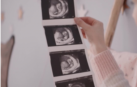 Bộ Y tế đề xuất các cặp vợ chồng được tự quyết định số con