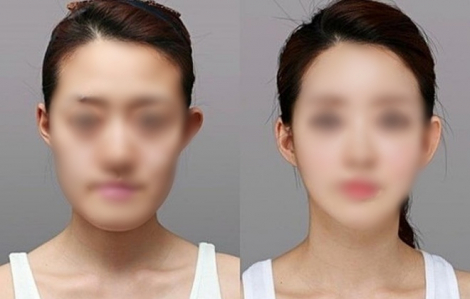 Người đã phẫu thuật thẩm mỹ gương mặt nên làm gì để không gặp khó khi xuất nhập cảnh?