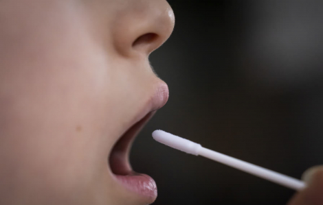 Anh nghiên cứu phương pháp phẫu thuật mũi để điều trị bệnh nhân COVID-19 kéo dài