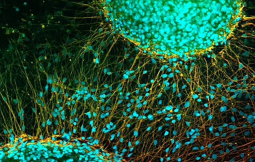 Nhật Bản nghiên cứu cấy ghép tế bào gốc bằng thuốc tiêm