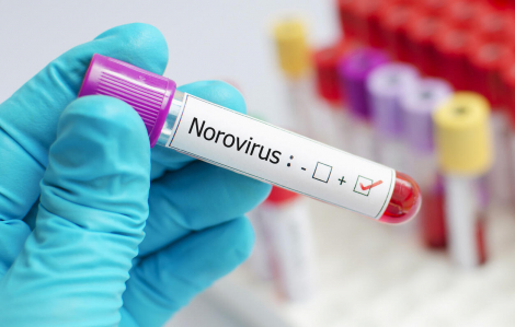 Nhật Bản cảnh báo việc ăn thực phẩm sống khi số người viêm dạ dày ruột tăng kỷ lục