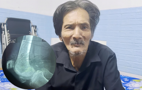 Nghệ sĩ Thương Tín bị vỡ khớp gối, không phải bị liệt