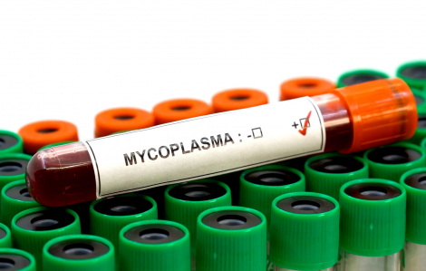 Bộ Y tế thông tin nhanh về căn bệnh "bí ẩn" ho ra máu tại Nga