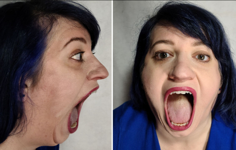 Người phụ nữ Mỹ lập kỷ lục Guinness vì khẩu hình miệng rộng bất ngờ