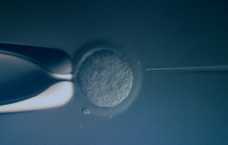 Một phụ nữ sinh con của người khác do bị chuyển nhầm phôi