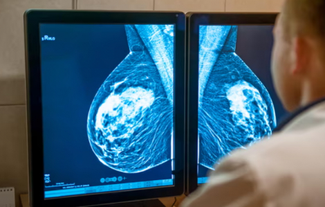 Anh cấp phép sử dụng thuốc điều trị ung thư vú mang tính đột phá