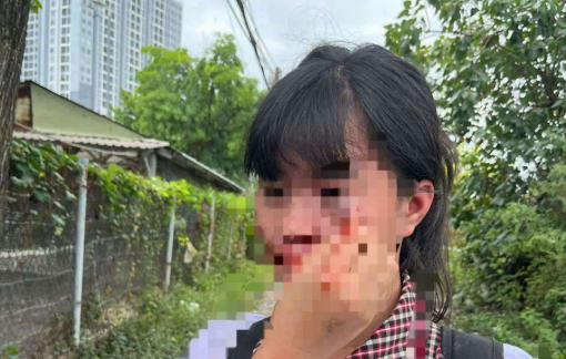 Nữ sinh bị đánh, mặt mũi quần áo bê bết máu