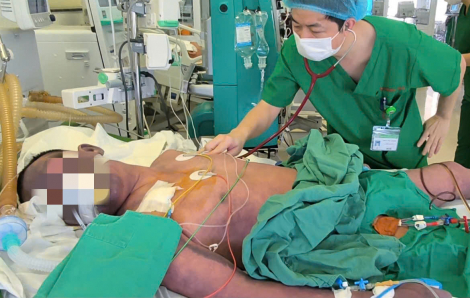 Ăn lòng lợn, người đàn ông hoại tử tím đen toàn thân