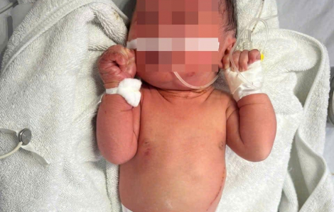 Bé sơ sinh bị bỏ rơi ở bụi chuối, côn trùng đốt khắp người