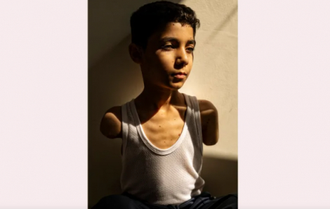 Bức ảnh cậu bé Palestine cụt cả 2 tay giành giải thưởng Ảnh báo chí thế giới