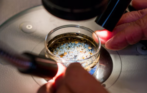 Lần đầu tiên phát hiện vi nhựa trong dịch nang buồng trứng