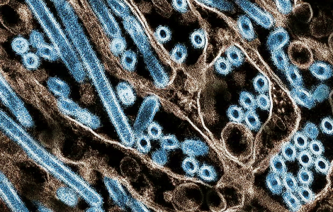 Hy vọng mới về vắc xin cúm gia cầm