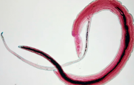 Giun ký sinh làm tăng nguy cơ ung thư cổ tử cung