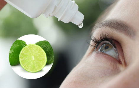 Hiểm hoạ khôn lường từ trào lưu nhỏ nước cốt chanh vào mắt