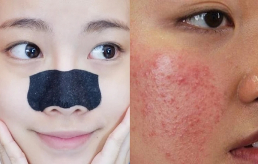 7 loại mỹ phẩm phổ biến cần tránh để không gây hại cho da