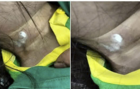 Bé gái 7 tuổi tử vong bất thường sau khi nhập viện