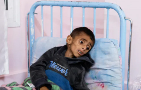 WHO: Toàn cầu đang đối mặt với cuộc khủng hoảng tài trợ y tế tồi tệ nhất