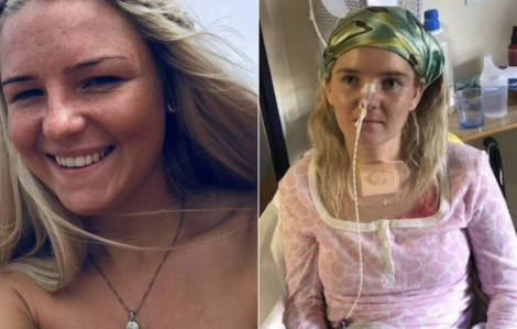 Âm nhạc giúp tăng cường trí nhớ cho các nạn nhân đột quỵ