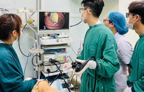 Rối loạn tiêu hóa kéo dài, bất ngờ phát hiện bã thức ăn trong dạ dày to như quả trứng