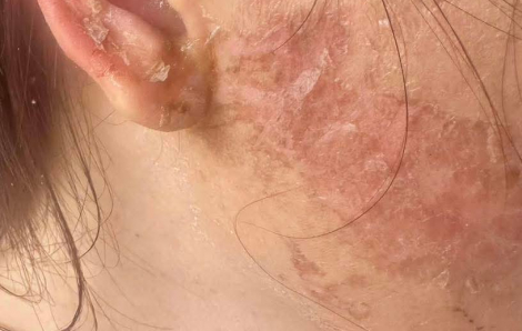 Khởi tố vụ án người phụ nữ bị cắt tóc, xăm mặt do ghen tuông ở Cà Mau