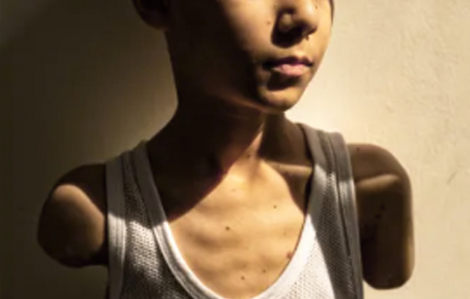 Một thế hệ không lành lặn ở Gaza