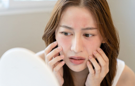 Tình trạng thiếu ngủ vào mùa nắng nóng gây hại cho da như thế nào?