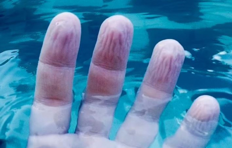 Vì sao tay bạn nhăn khi ngâm nước?