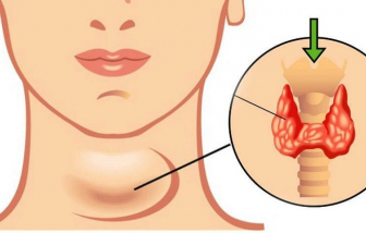 Thức dậy sớm thường xuyên cũng là dấu hiệu tiềm ẩn bệnh nguy hiểm